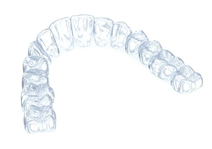 MTM Clear Aligners in Kansas City
